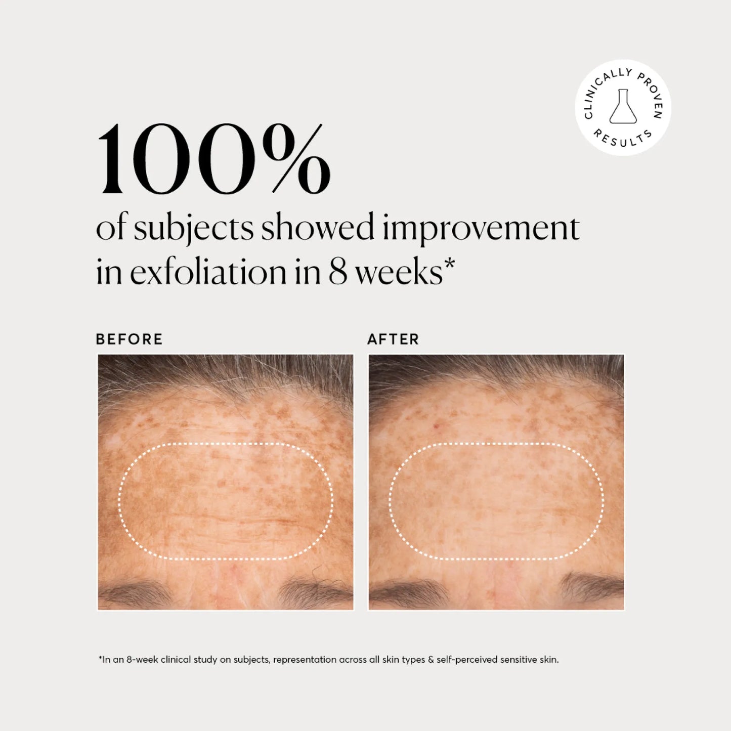 bha-liquid-exfoliant-2-s5 NATR-10027-Alt-Images-BHA-Liquid-Exfoliant-2_-03.webp
