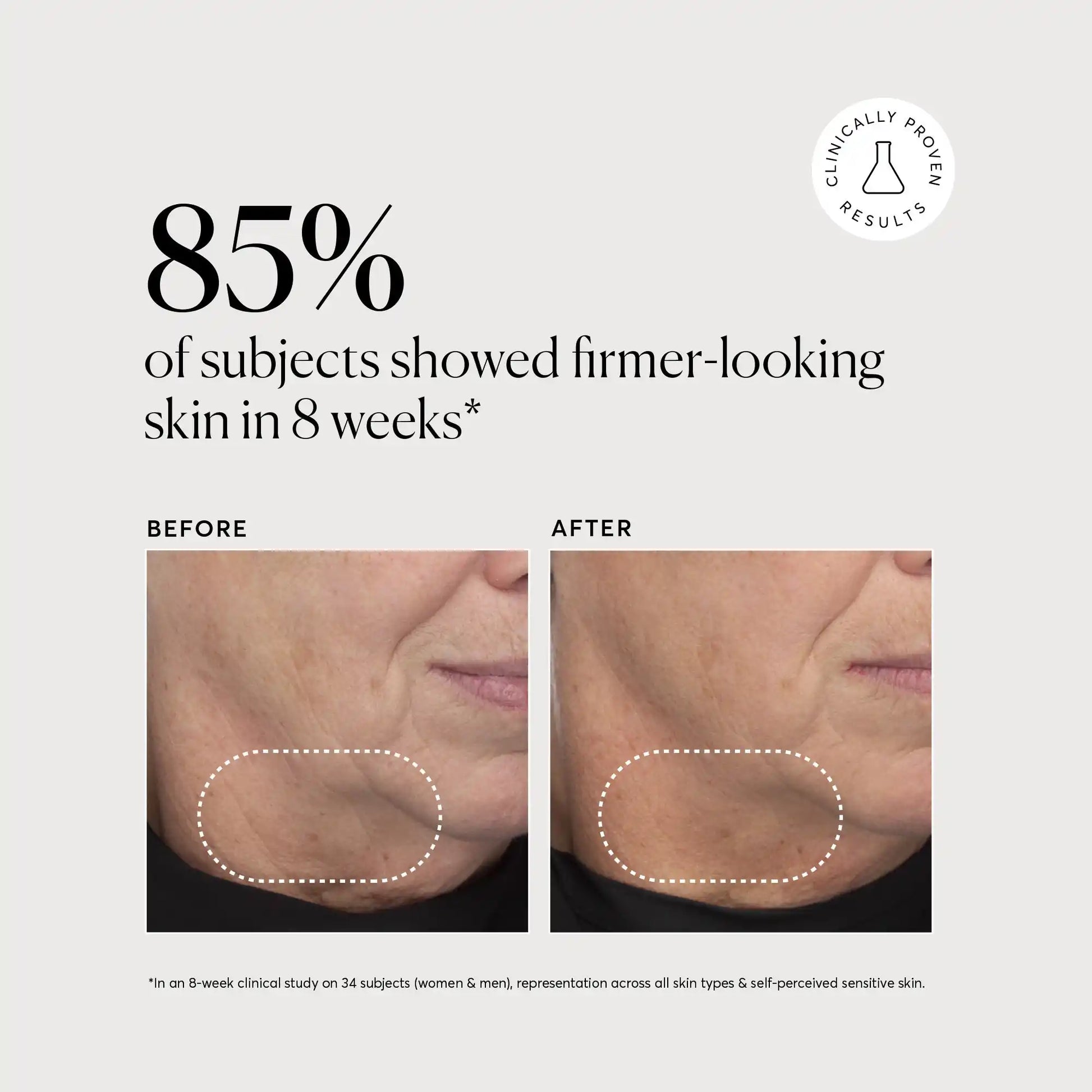 retinol-complex-serum-x5 NATR-10034-Alt-Images-Retinol-Complex-Serum-04.webp